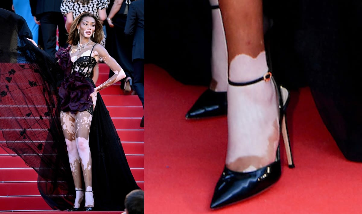 Winnie Harlow Elevates Lingerie Dressing With Slingback Pumps for Cannes Film Festival 2024
