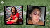 Jugadora de Tijuana recibió codazo, pero el árbitro la amonestó: “no me sentí protegida” | Fútbol Radio Fórmula