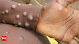 MPOX Virus: 'deadliest' mpox variant spreads in multiple african countries; know signs and symptoms | - Times of India