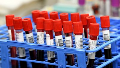 New blood test could help detect Alzheimer’s