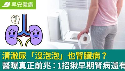 清澈尿「沒泡泡」也腎臟病？醫曝真正前兆：1招揪早期腎病還有救