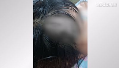 家長叫小孩水槍丟水池 女童遭砸中頭流血縫針