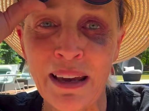 Sharon Stone Shows Off Shiner To Reassure Concerned Fans: 'I Know You're All Worried'