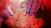 What Exactly Are PRP Facial Treatments?