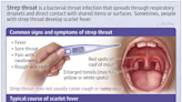 Patient Information: Strep Throat