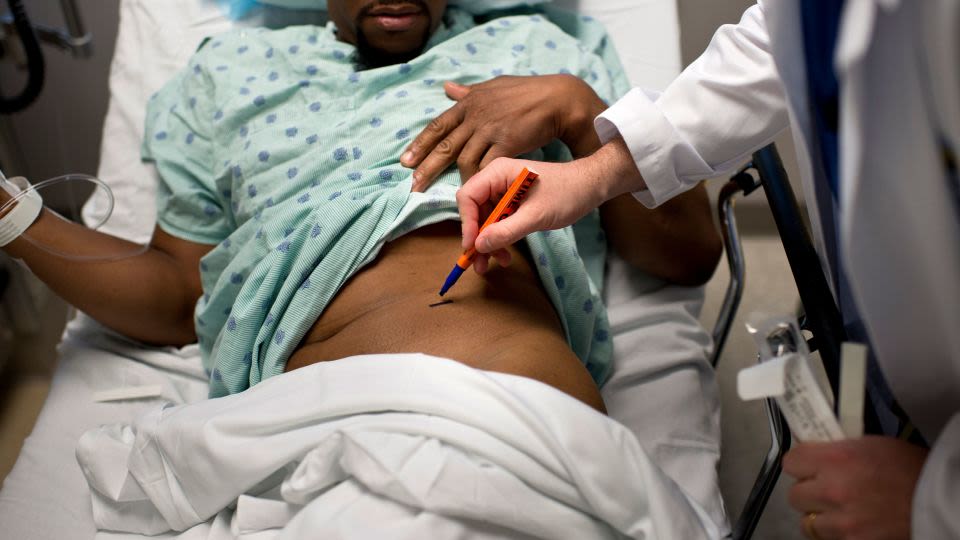 Despite high demand, kidneys donated by Black Americans are more likely to be thrown away. Here’s why