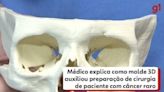 Médico usa molde 3D de crânio de paciente com câncer raro para simular operação e aumentar precisão da cirurgia, no Paraná