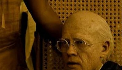 Jóvenes que vivieron como ancianos: 4 casos terribles de niños con síndrome de Benjamin Button