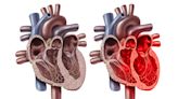 男子笨豬跳後死亡專家指受驚嚇引發心臟病 提醒市民日常過於激動或可導致心肌梗塞