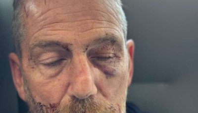 ‘They were like a pack of hyenas’ - assault victim (62) appeals to community to help police catch attackers