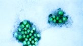 Norovirus appears to be spreading as rate of positive tests spikes