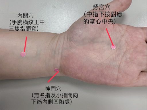 針灸調心脾忌冰辣 嬤甩失眠