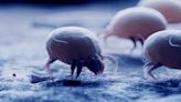 Immunologists Want You to Know These Dust Mite Allergy Facts