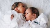 Woman births twin girls from rare double uterus