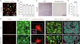 Study finds astrocytic pH regulator can repair blood-brain barrier, reverse brain damage caused by ischemic stroke