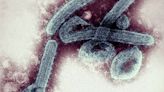 Preocupación por primer brote en Ghana del mortal virus de Marburgo, de la misma familia que el ébola