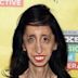 Lizzie Velásquez