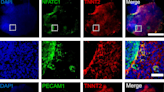 Engineering mini human hearts to study pregnancy complications and birth defects