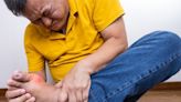 痛風發生率不只男女有別，與種族也有關係，典型4大症狀