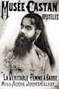 Annie Jones (bearded woman)