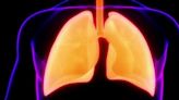 Iron fuels immune cells – and it could make asthma worse