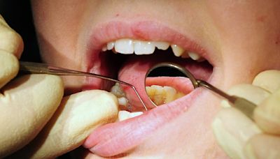 Children in most-deprived areas ‘three times more likely’ to need teeth removed