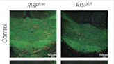 Mitochondria support immune response to central nervous system injuries, scientists discover