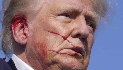 Blood scarred: Editorial on assassination attempt on Donald Trump and history of political violence in USA