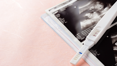 子宮外孕胎兒一定保不住嗎？醫師曝可能著床位置「這處」妳一定想不到！