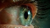 Here's What The Colour Of Your Eye Crust Says About Your Health