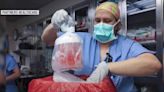 全球首例「基改豬腎移植人體」 美62歲男手術7週後身亡