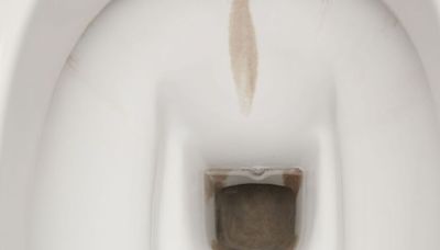 Remove limescale from toilet with better than bleach item that is game-changing