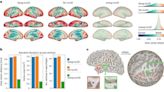 New template of the human brain enhances neuroimaging data analysis