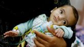 In Gaza, starving children fill hospital wards as famine looms