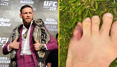 8Conor McGregor makes bold career prediction as UFC stars mock his broken toe