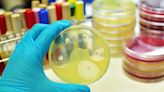 Battling bacterial behemoths: The AMR and MRSA challenge