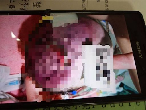 台中孕媽「吃全餐」嬰出生卻死亡⋯醫判賠千萬！醫界跳腳 阿公怒回