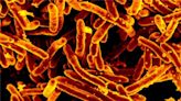 Tuberculosis cases are way up in Worcester: Should residents be concerned?