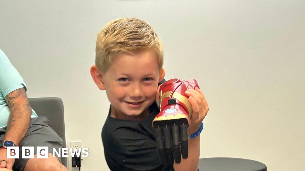 Boy, five, is world’s youngest to receive bionic hero arm