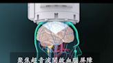 《淚之女王》腦瘤3國拚試驗 醫：台灣最快3年後臨床應用 - 自由健康網