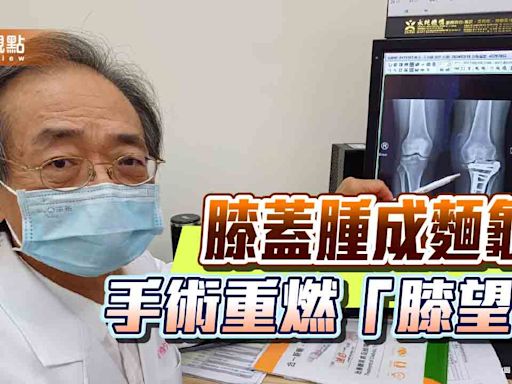 30歲女搬家膝蓋腫成麵龜 人工膝關節換置重燃膝望