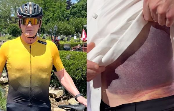 Gordon Ramsay Says He’s Lucky to Be Alive After Terrifying Bike Accident