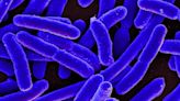 What is E.coli as one person confirmed dead amid outbreak?