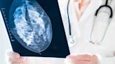 Confused by new mammogram guidelines? Here’s what to know.