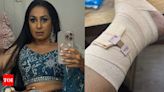 Kashmera Shah has a major fall on the sets of Laughter Chefs; shares pics of her injured ribs and ankle | - Times of India