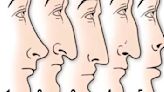Entérate si eres una persona con complejos, según cuál es la forma de tu nariz