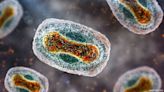 First U.S. Monkeypox-Related Death Reported in Texas