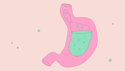 Acid reflux bothering you? Here's a gut expert's guide to handling the digestive issue