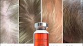 Treat hair loss FAST with this stem cell serum and get a free $195 GWP