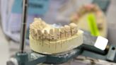 Dental Implant Maker ZimVie Weighs Potential Sale